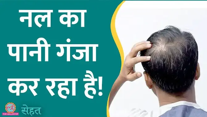Hair Loss Prevention Sehat