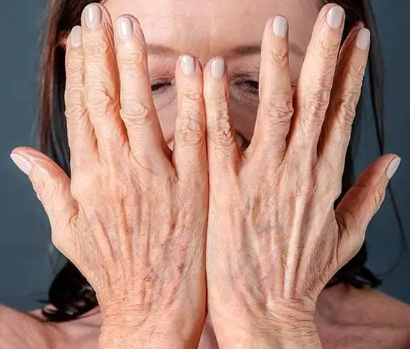 Ageing Hands Treatment Dwarka