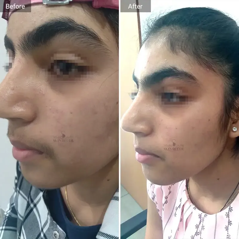 Skin Decor Clinical Transformation Result